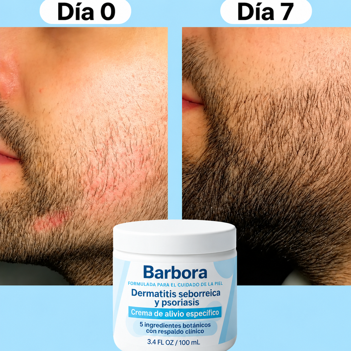 Barbora™ Crema Alivio para Barba